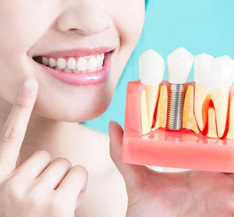 Зубні імпланти: «за» та «проти» встановлення