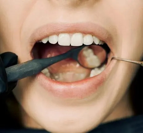 Чи можна лікувати пародонтоз у домашніх умовах?